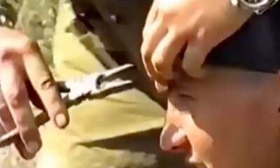 A dead bullet, unknown from where it came from, was stuck in the forehead of the soldier who was practicing in the military field, another soldier took it out immediately.